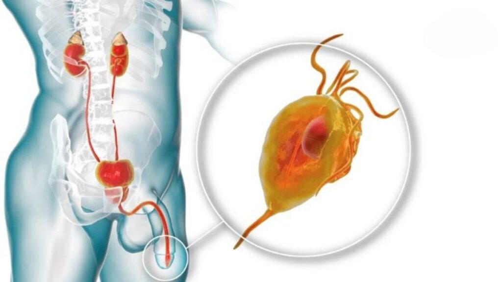 Các nhóm nguyên nhân có thể gây xuất tinh ra máu