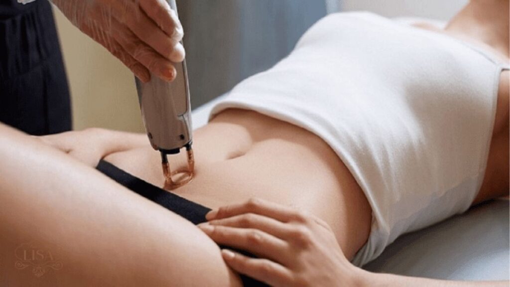 Cách khắc phục cô bé bị thâm an toàn, nên bắt đầu từ đâu? 5 Cạo và wax vùng kín có thể gây kích ứng da