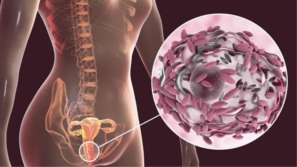 dấu hiệu khô âm đạo cần đi khám thay vì tiếp tục dùng thực phẩm chức năng