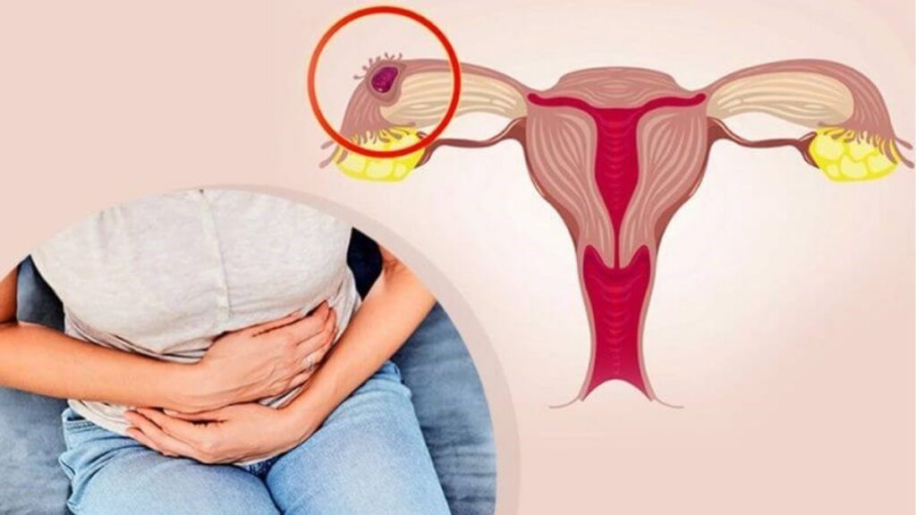 Khô rát và đau khi quan hệ có thể khiến phụ nữ giảm ham muốn