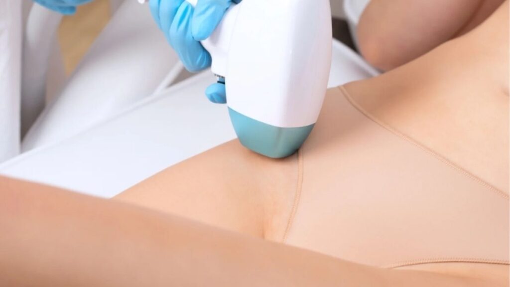 Cách khắc phục cô bé bị thâm an toàn, nên bắt đầu từ đâu? 12 Bác sĩ tư vấn laser trị thâm vùng kín