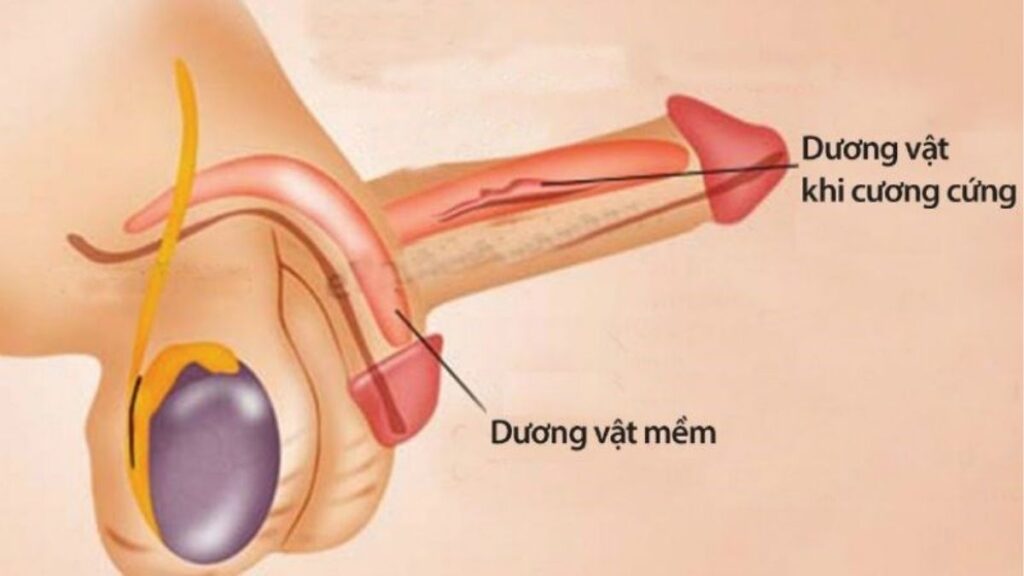 Những việc nên làm khi mới gặp tình trạng khó cương