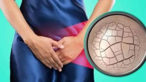 thực phẩm chống khô hạn ở phụ nữ gồm đậu nành cá béo hạt và rau quả