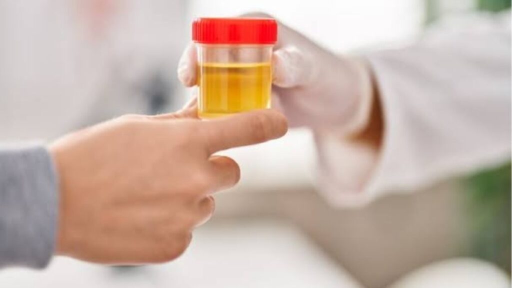 Xuất tinh ngược dòng là gì? Dấu hiệu, nguyên nhân và khi nào cần khám 7 Xét nghiệm nước tiểu sau cực khoái chẩn đoán xuất tinh ngược dòng