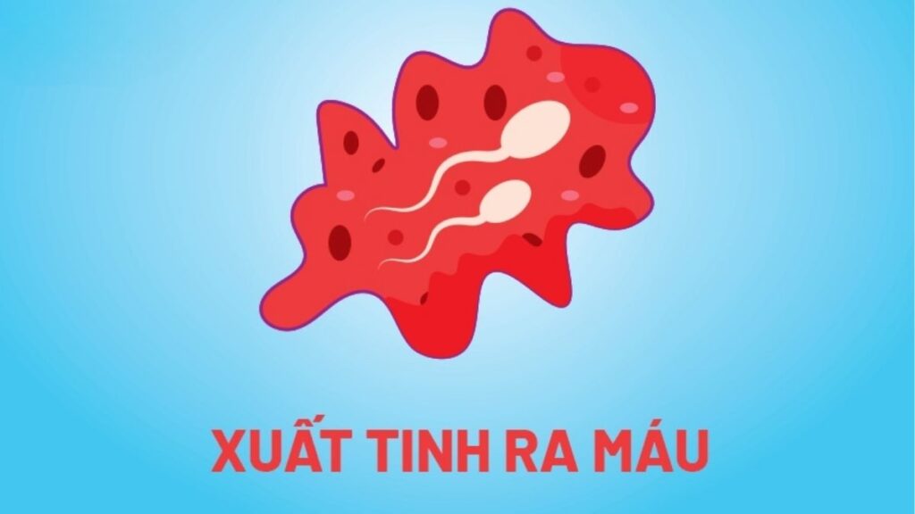 Xuất tinh ra máu là hiện tượng máu xuất hiện trong tinh dịch