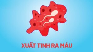 Xuất tinh ra máu là hiện tượng máu xuất hiện trong tinh dịch